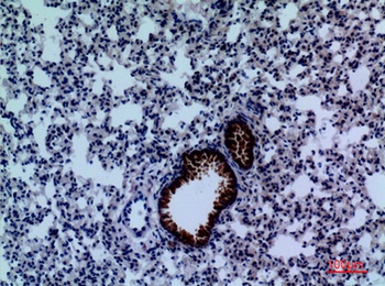 DPYD rabbit pAb Antibody