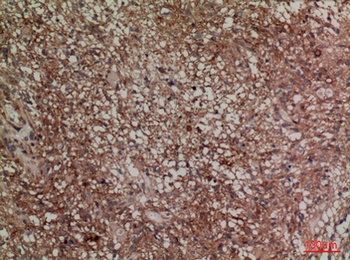 SNAP 23 rabbit pAb Antibody