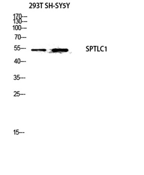 SPTLC1 rabbit pAb Antibody