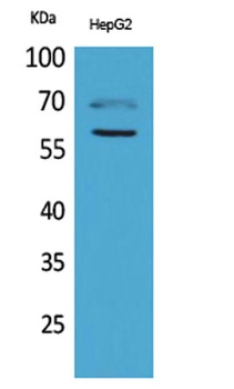 HEXA rabbit pAb Antibody