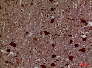 HEXA rabbit pAb Antibody