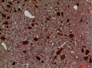 HEXA rabbit pAb Antibody