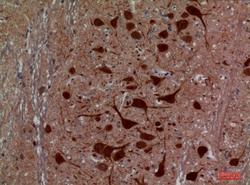 HEXA rabbit pAb Antibody
