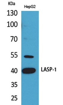 LASP-1 rabbit pAb Antibody