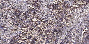 LASP-1 rabbit pAb Antibody