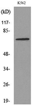 Transferrin rabbit pAb Antibody