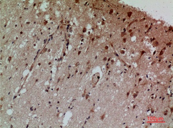 CD58 rabbit pAb Antibody