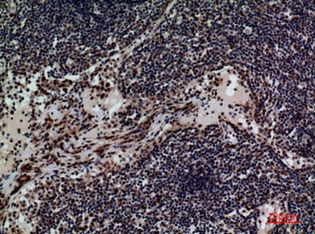 CD79b rabbit pAb Antibody