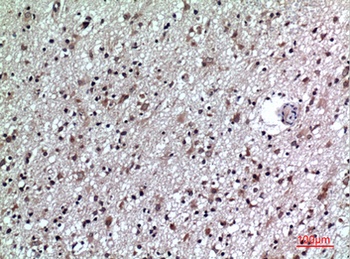 CD84 rabbit pAb Antibody