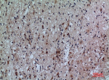 CD307 rabbit pAb Antibody