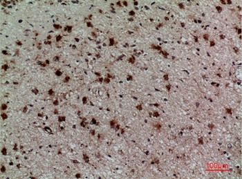 CD158z rabbit pAb Antibody
