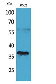 CD207 rabbit pAb Antibody