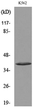CD207 rabbit pAb Antibody