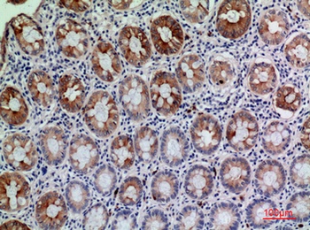 CD177 rabbit pAb Antibody