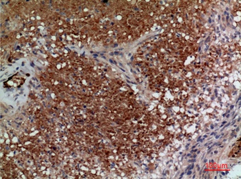 CD241 rabbit pAb Antibody