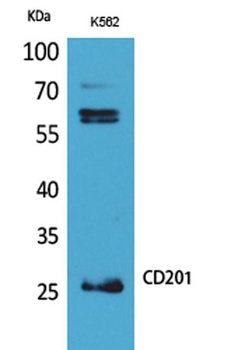 CD201 rabbit pAb Antibody