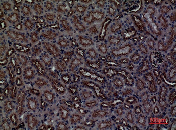 CDCP1 rabbit pAb Antibody