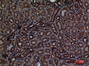 CDCP1 rabbit pAb Antibody