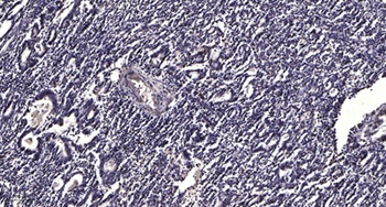 MCP-2 rabbit pAb Antibody
