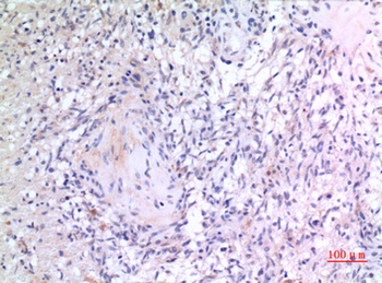 VGF rabbit pAb Antibody