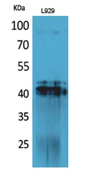 PDGF-D rabbit pAb Antibody