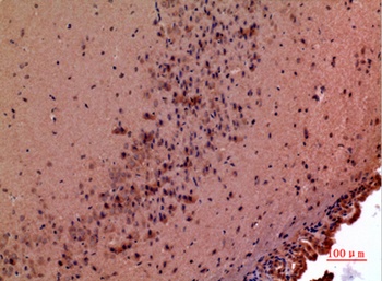 GDF-5 rabbit pAb Antibody