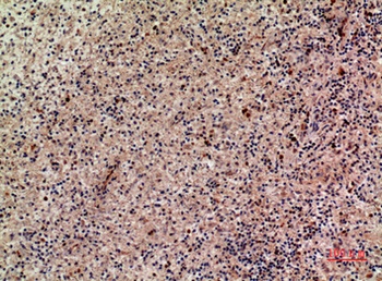 Lymphotactin rabbit pAb Antibody
