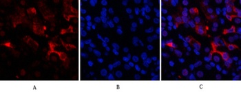Bcl-6 rabbit pAb Antibody