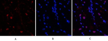 Bcl-6 rabbit pAb Antibody