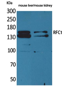 RFC1 rabbit pAb Antibody