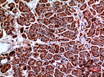 Amphiphysin II rabbit pAb Antibody