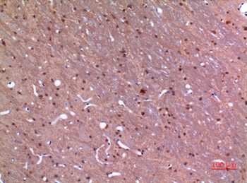 GDI-2 rabbit pAb Antibody