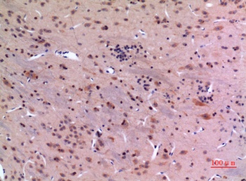 GDI-2 rabbit pAb Antibody