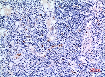 IDH3A rabbit pAb Antibody