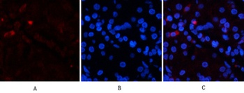 EPAS-1 rabbit pAb Antibody