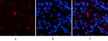 EPAS-1 rabbit pAb Antibody