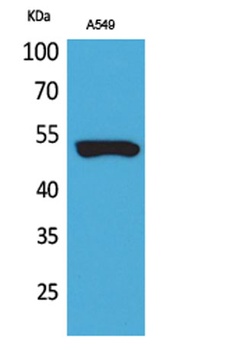 Cytokeratin 8 rabbit pAb Antibody