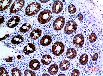 Cytokeratin 8 rabbit pAb Antibody