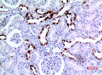 Cytokeratin 8 rabbit pAb Antibody
