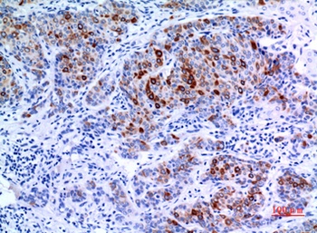 Keratin-pan rabbit pAb Antibody