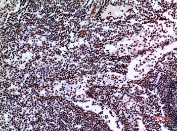 p73 rabbit pAb Antibody