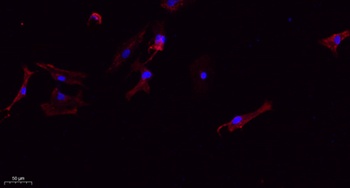 IL-6 rabbit pAb Antibody