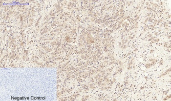 IL-6 rabbit pAb Antibody