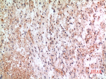 Fractalkine rabbit pAb Antibody