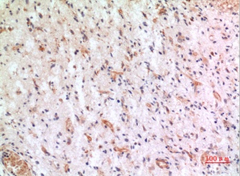 Fractalkine rabbit pAb Antibody