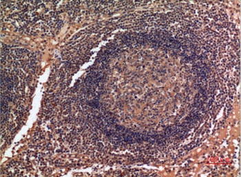 ALDH2 rabbit pAb Antibody