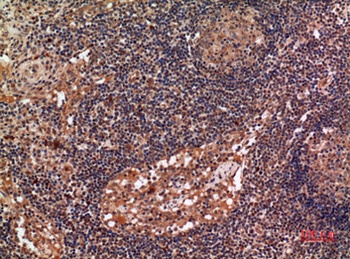 ALDH2 rabbit pAb Antibody