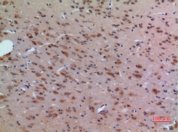 Arg rabbit pAb Antibody