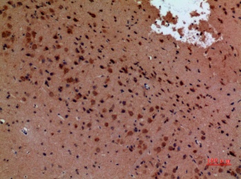 Arg rabbit pAb Antibody