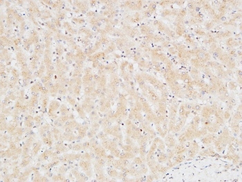Troponin T-C rabbit pAb Antibody